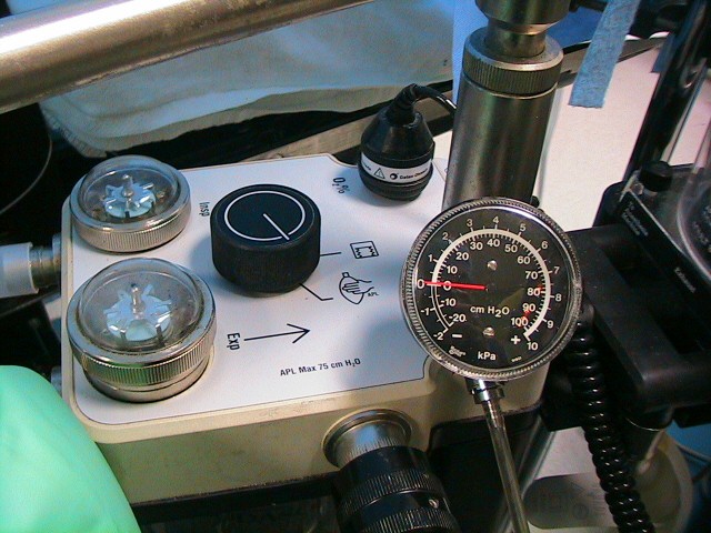 Airway Pressure Gauge