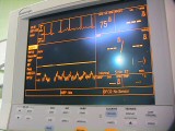 Anesthesia Monitor