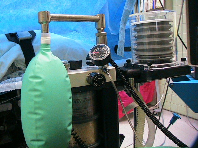 Anesthesia Ventilator Breathing Machine